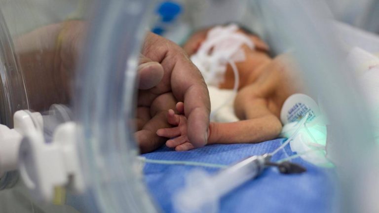 Prematüre Bebek Nedir – Özellikleri ve Merak Edilenler
