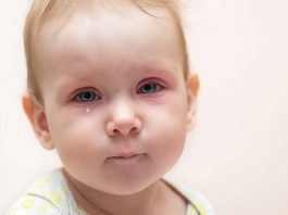 bebeklerde gözyaşı kanalı tıkanıklığı